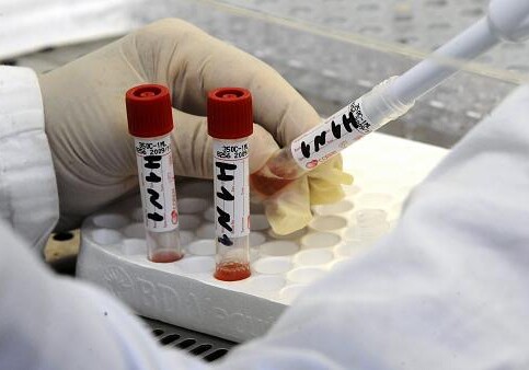 56,2 процента случаев заражения коронавирусом в Азербайджане приходится на столицу