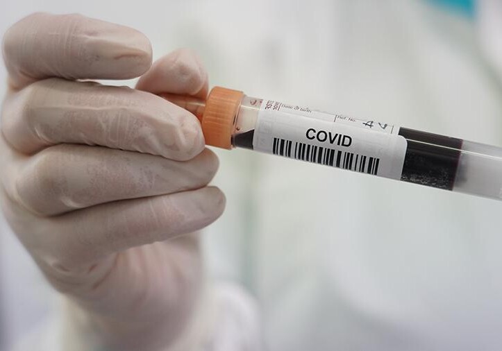 Число инфицированных коронавирусом в мире составило 36,8 млн