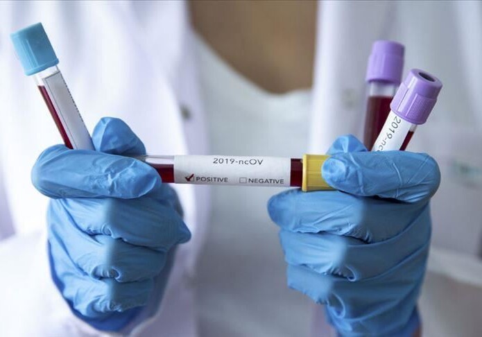 В Азербайджане выявлено еще 527 случаев заражения коронавирусом