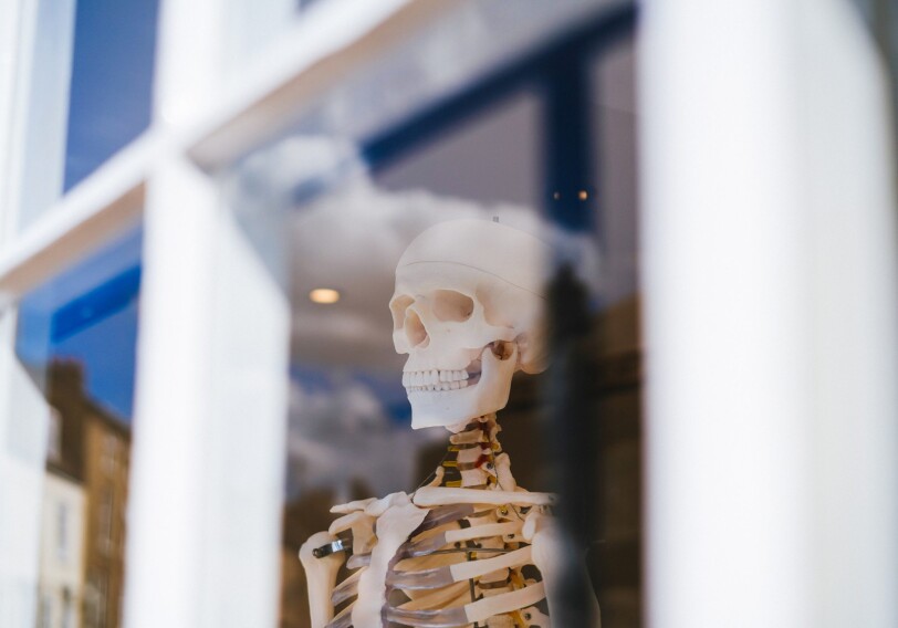 Исследователи научились распечатывать кости в организме человека