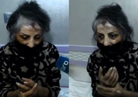 Заслуженная артистка Азербайджана попала в больницу (Фото)