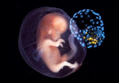 Австралийские ученые вырастили модель эмбриона из клеток кожи