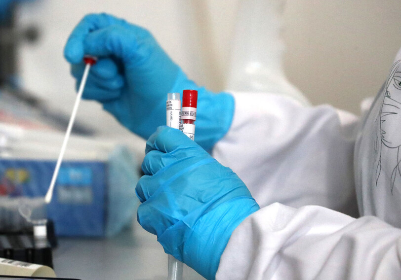 В Азербайджане зарегистрировано 2035 новых фактов заражения коронавирусом