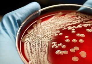 Ученые разработали нанопокрытие, уничтожающее супербактерии и грибки