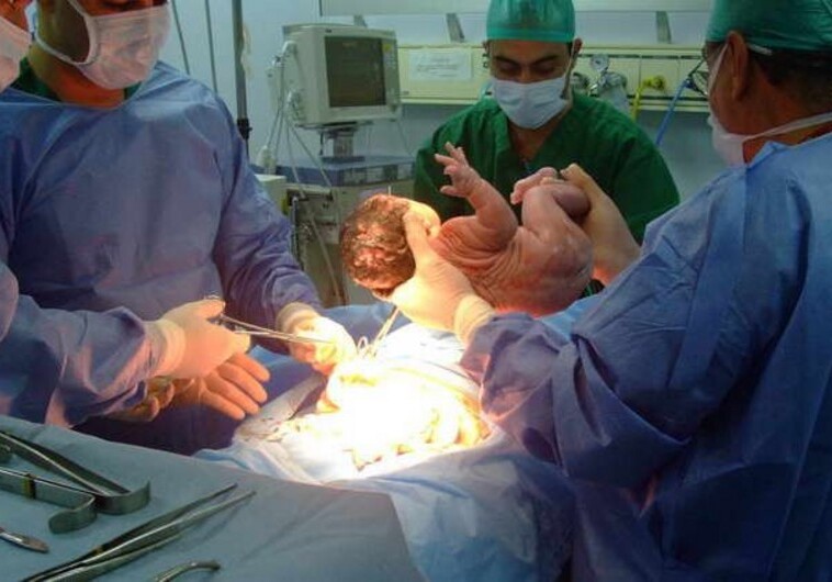 В Баку близнецы умерли до рождения - Халатность врачей?