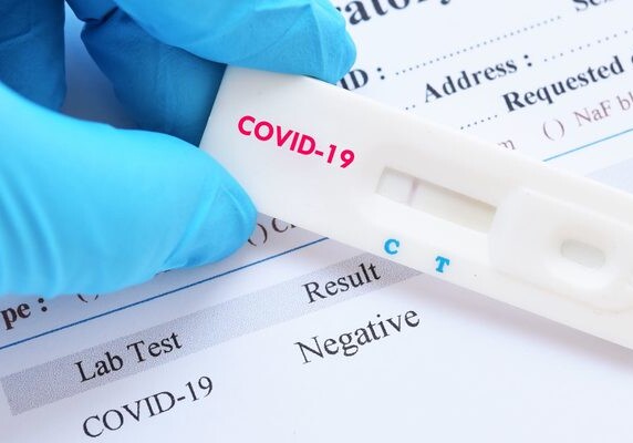 В Азербайджане за сутки от COVID-19 заразились 844 человека