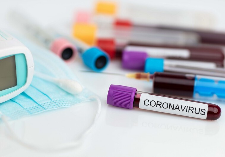 В Азербайджане за сутки коронавирусом заразились 472 человека - Статданные Оперштаба
