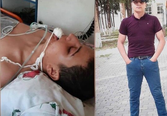 Генпрокуратура распространила заявление в связи с избиением 14-летнего подростка в Агсу