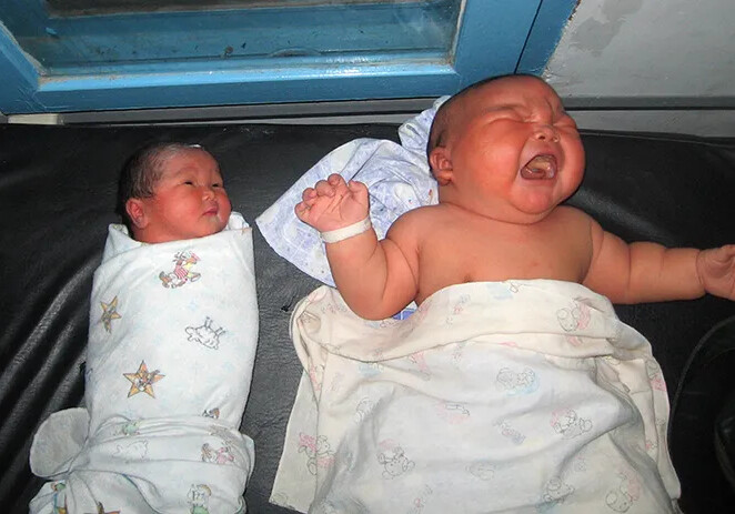 Чуть-чуть не хватило до 10 кг: 5 самых тяжелых новорожденных в мире (Фото)