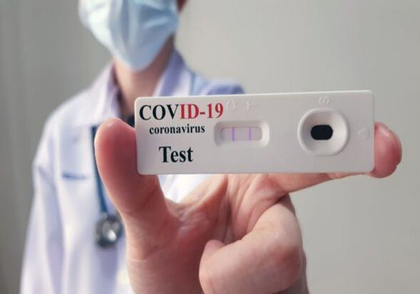 Насколько точны аптечные тесты по выявлению COVID-19? - Заявление TƏBİB (Видео)