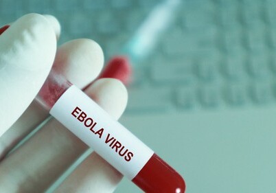 Вирус Эбола смог выжить в организме человека в течение 5 лет