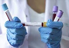 В Азербайджане зарегистрировано 1013 новых фактов заражения коронавирусом - Статданные Оперштаба