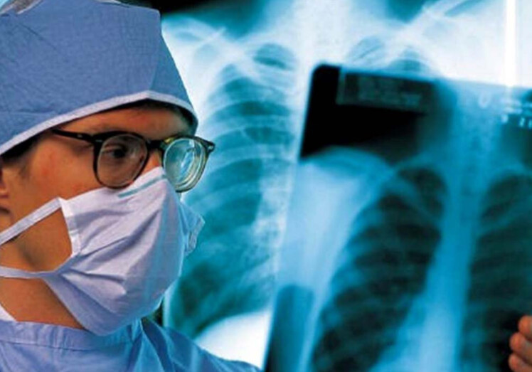 ВОЗ забила тревогу из-за роста смертности от туберкулеза