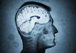 Ученые объяснили, почему уменьшился мозг современного человека