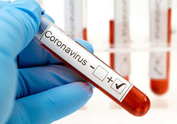 Число случаев заболеваний COVID-19 в мире с начала пандемии превысило 300 млн