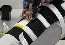 На МКС создадут бинты из кожи космонавтов