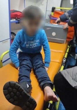 Ногу ребенка затянуло в эскалатор в бакинском торговом центре (Видео)