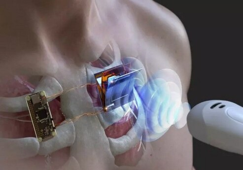 Создана беспроводная зарядка для устройств, которые находятся в теле человека