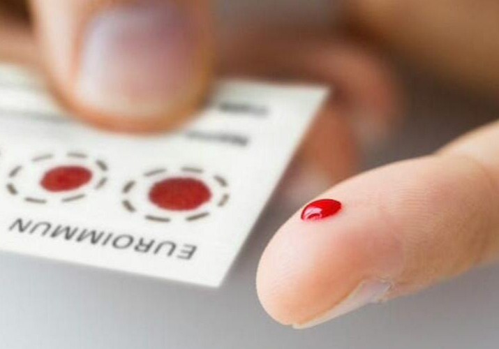 ВИЧ, гепатит В и С можно определить одновременно по сухой капле крови
