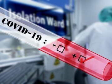 Сенат США: Пандемия COVID-19 произошла из-за ЧП с исследованием 