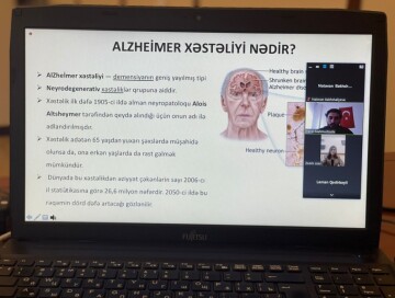 Семинар по лечению болезни Альцгеймера состоялся в БГУ