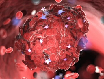 Ученые представили новую стратегию для лечения тромбоза без осложнений
