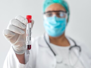 Moderna анонсировала испытания вакцины от оспы обезьян