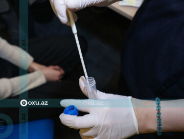 В Азербайджане за последние сутки коронавирусом заразились 26 человек - Статданные Оперштаба